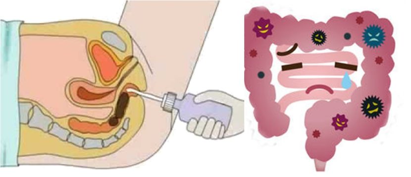 BASTI,BASTI-KARMA,PANCHAKARMA,AYURVEDA-PANCHKARMA,SHREE-VISHVATEJ,SHREE-VISHVATEJ-AYURVEDIY-YOGA-CHIKITSALAYA,BASTI-KARMA-AT-GHATKOPAR,BEST-BASTI-TREATMENT-AT-GHATKOPAR,SHREE-VISHVATEJ,BEST-PANCHKARMA-CLINIC,PANCHKARMA-TREATMENT-IN-GHATKOPAR,BASTI-TREATMENT,